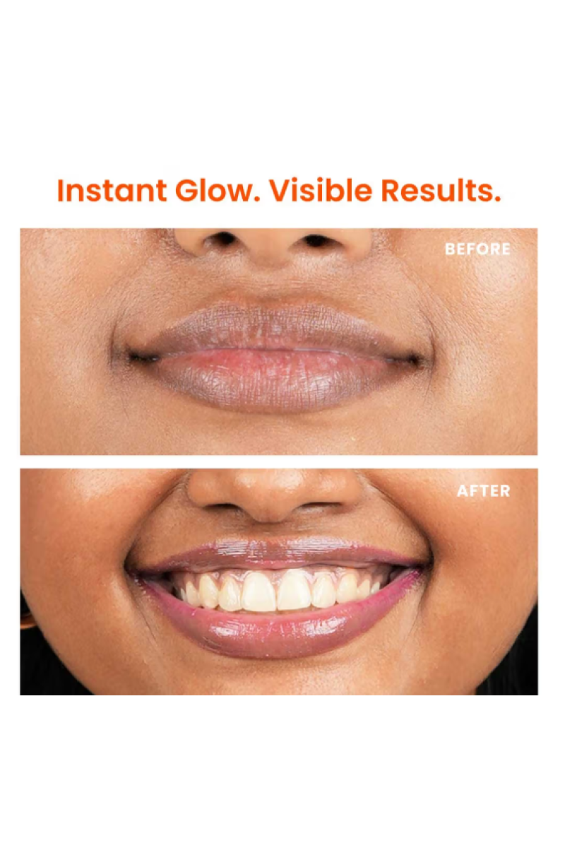 Foxtale Brightening Lip Balm with Peptides, Vitamin C & Hyaluronic Acid for Dry Lips & Pigmentation (12g)
