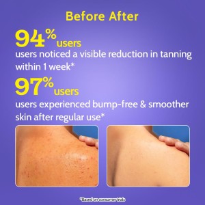 Chemist At Play Exfoliating Body Wash 236ml | Removes Tan, Fights Body Acne, Strawberry Skin | 4% (Salicylic Acid, Vitamin E & Lactic Acid) | Gentle Exfoliating Detan Shower Gel For Women & Men